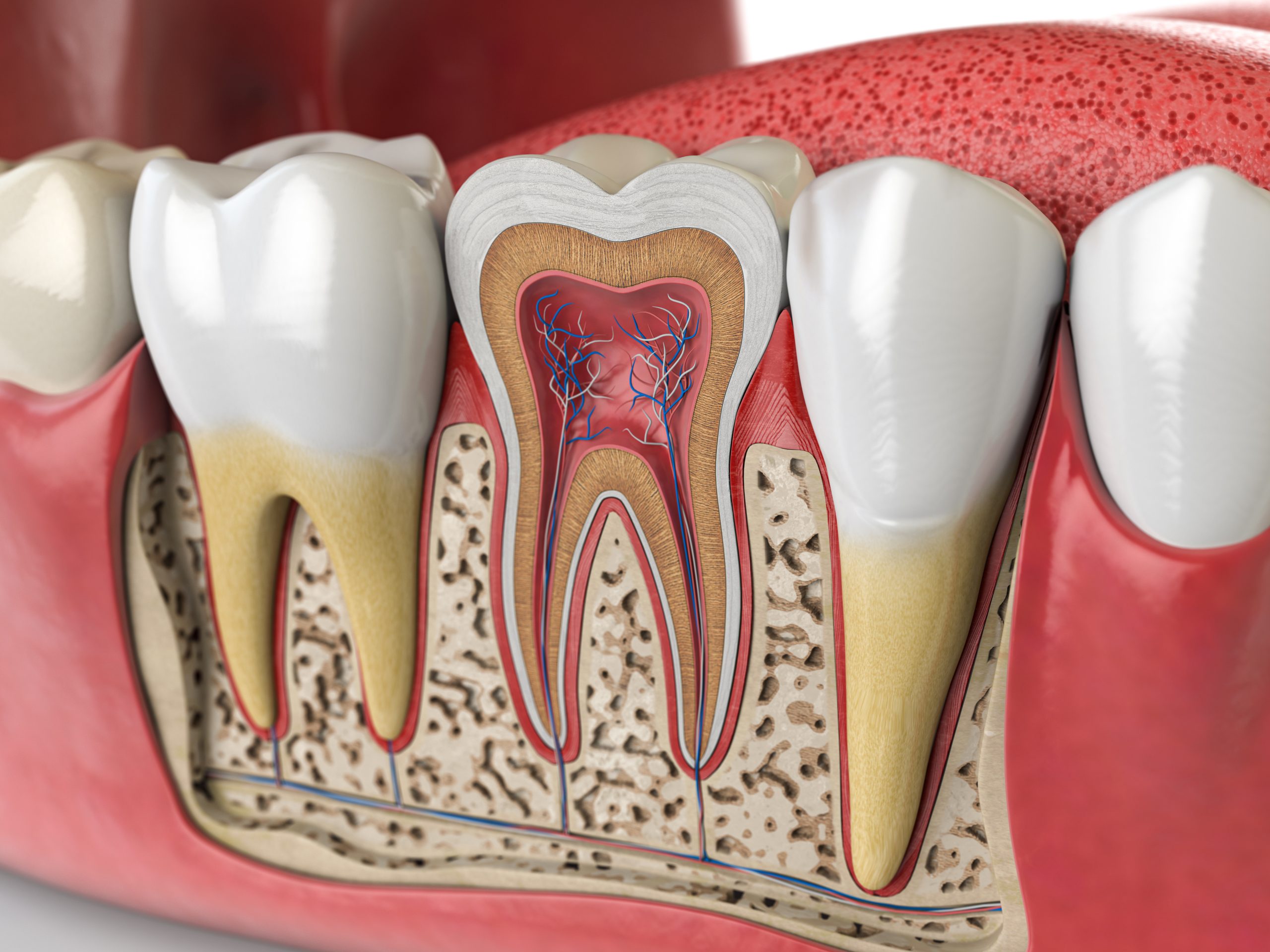 Root Canals Root Canals
